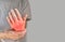 Hand joints inflammation. Concept of rheumatic arthritis, rheumatism, gout, joint swelling or arthralgia