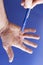 Hand of an man with Dupuytren contracture on blue