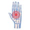 Hand pain icon cartoon vector. Arthritis joint