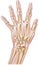 Hand - Rheumatoid Arthritis of the Joints