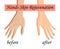 Hand skin rejuvenation, vector illustration isolated on the white background