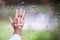 The hand with vitiligo