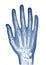 Hand xray