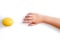 Hands of the child and lemon. Dark damaged nails and skin of hands. Vitamin deficiency or allergies. Avitaminosis care concept