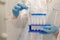 hands of a nurse in blue medical gloves hold test tubes with biomaterial, laboratory tests, biopsy, DNA test