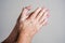 Hands with vitiligo skin problem clapping on isolated background