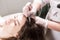 Handsome woman receives an injection in the head. The procedure makes doctor in white gloves. The concept of mesotherapy