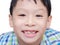 Happy Asian boy toothless smile close-up