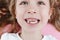 Happy smiling child portrait on the pink background. Close-up of teeth. Little todler attractive lovely sweet curious cheerful
