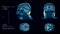 Head and brain computer tomography result visualization. Four partitions slides of human head screening. 3D medical radiology