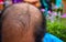 Head lose hair.Close up of head Asian man less hair. Glabrous