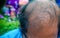 Head lose hair.Close up of head Asian man less hair. Glabrous