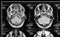 Head magnetic resonance image