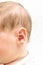 Head of the newborn baby first hear on white background, baby ear close up, macro shot of the hearing aid, earache,