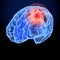 Headache X-Ray 3D model. Brain neurons synapse, anatomy body. Medical illustration of disease, head pain