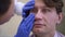 Headshot portrait of brunette adult Caucasian man with grey eyes in hospital with doctor examining pupil. Close-up of