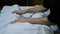 Health and overweight concept. masseur`s hands make remedial massage through towel. massage to adult fat woman`s legs in