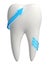 Healthy 3d white tooth icon - Blue arrows