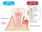 Healthy and diseased gum. dental biofilm. dental and health care concept