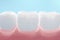 Healthy gums and teeth coating by fluoride