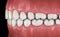 Healthy human teeth with normal occlusion, side view. Medically accurate tooth illustration