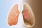 Healthy lung and cancer lung