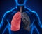 Healthy Lung and Smokers Lung