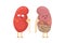 Healthy and sad suffering sick kidney with cancer characters. Human anatomy genitourinary system internal unhealthy