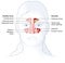 Healthy sinus and sinusitis, medical illustration, labeled