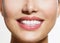 Healthy Smile. Teeth Whitenin