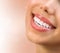 Healthy Smile. Teeth Whitening