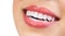 Healthy Smile. Teeth Whitening