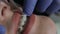 Healthy teeth. Close up A client at a dentist during a dental examination