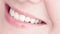 Healthy teeth, dental care and dentistry, perfect natural white toothy female smile closeup, cleaning and teeth