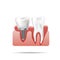 Healthy teeth and dental implant. Realistic illustration of tooth medical dentistry.