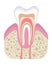 Healthy tooth is not infected with caries. Stage before of caries development. Tooth structure in flat style. Tooth with