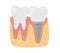 Healthy and unhealthy teeth prosthetics dental treatment stomatology vector illustration.