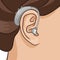 Hearing aid behind the ear, electronic device, BTE type. Hearing loss vector illustration, realistic style