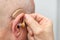 Hearing aid in the ear of aged old man