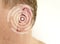 Hearing loss male defect symptom sign diagnosis