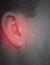 Hearing loss male defect symptom sign diagnosis loud