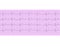 Heart analysis, electrocardiogram graph