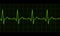 Heart beat. Cardiogram. Cardiac cycle