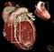 Heart bypass surgery. Multy-planar CT