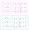 Heart Cardiogram Chart Vector. Set Healthy Heart Rhythm, Ischemia, Infarction. Vitality Heartbeat