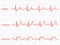 Heart cardiogram vector charts set. Healthy heart