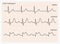 Heart cardiogram waves.