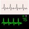 Heart cardiogram waves on graph paper and on monitor. Vector illustration.