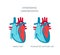 Heart disease vector concept in flat style