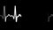 Heart rate in real-time on electrocardiogram display